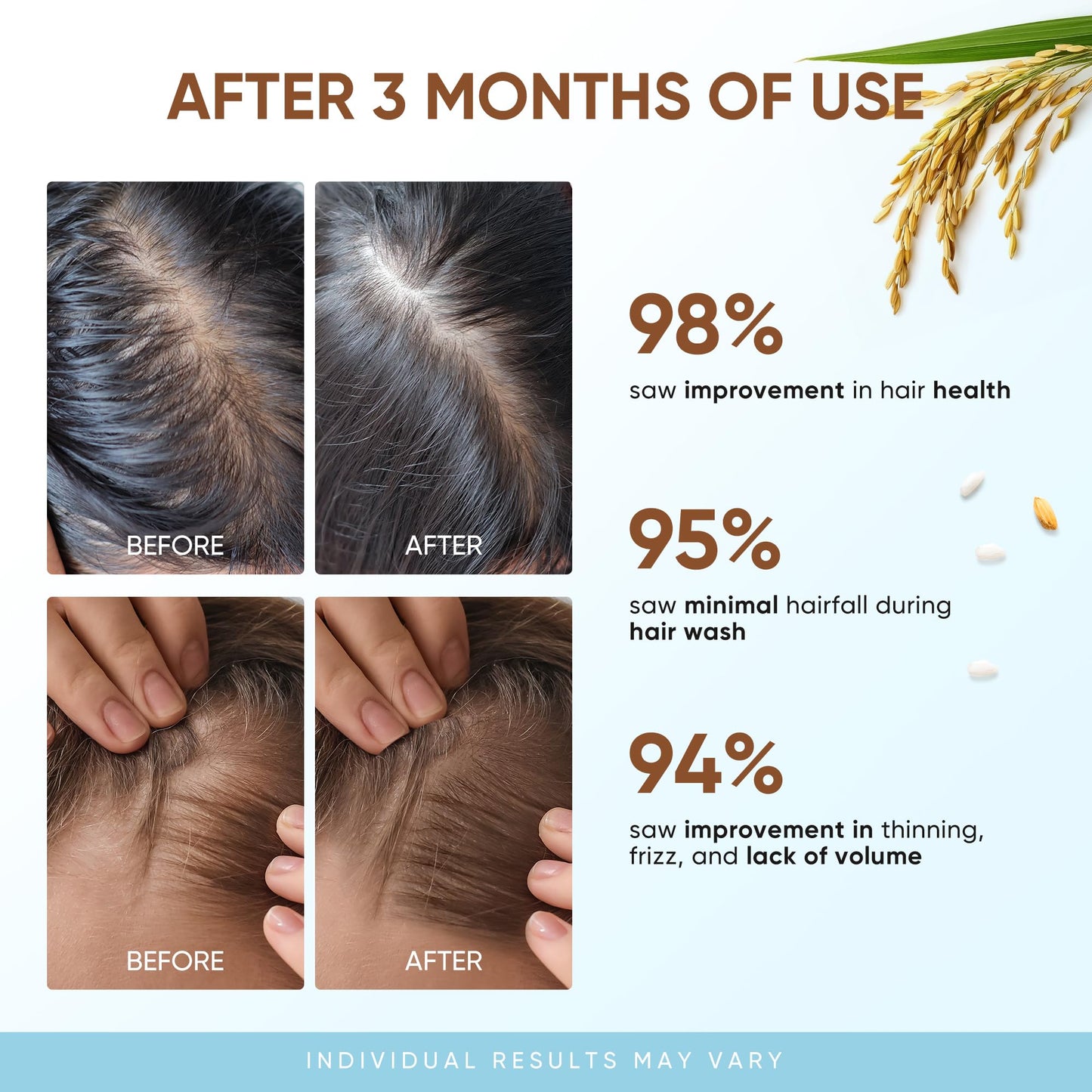 Svvimer Rice Water Hair Growth Shampoo - Biotin Thickening Shampoo for Hair Loss and Thinning Hair - Sulfate Free for Women and Men 10 Fl Oz (Pack of 1)