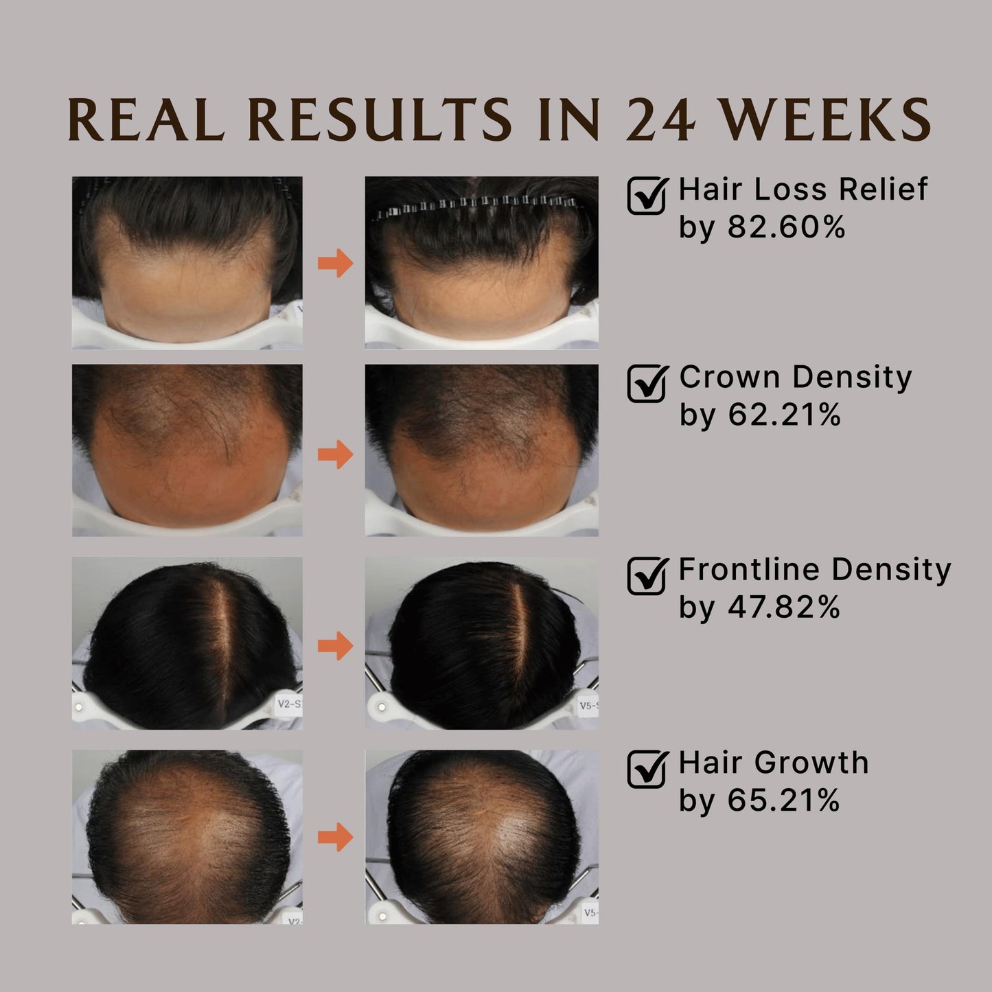 LA'DOR Dermatical Nourishing Strengthening Hair Mask Treatment - Hydrating Deep Conditioner for Dry Damaged Thinning Hair to Silky Hair Korean Haircare LADOR