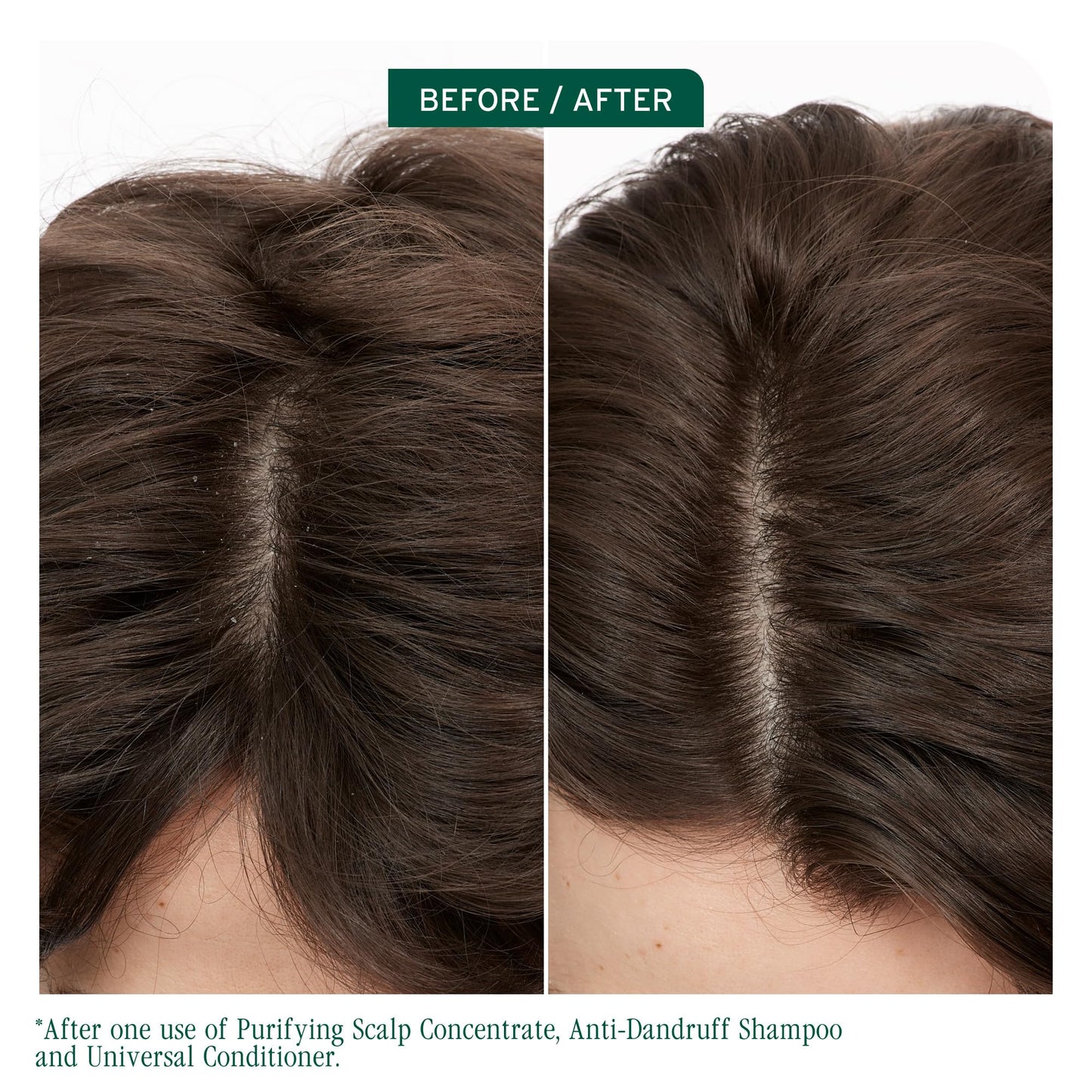 Biolage Scalp Sync Anti-Dandruff Shampoo 13.5 Fl. Oz - Targets Dandruff Control, Paraben Free, Vegan, Salon Shampoo, Controls The Appearance of Flakes & Relieves Scalp Irritation